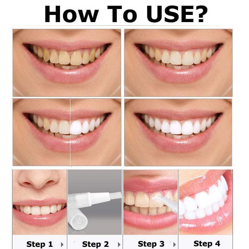 Vizzy Flawless Teeth Whitening Pen